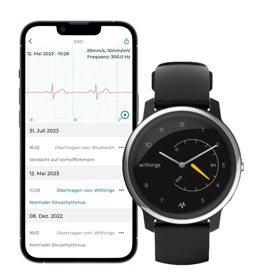 Smartphone mit EKG-Aufzeichnungen in der App neben einer Withings-Smartwatch mit EKG-Funktion